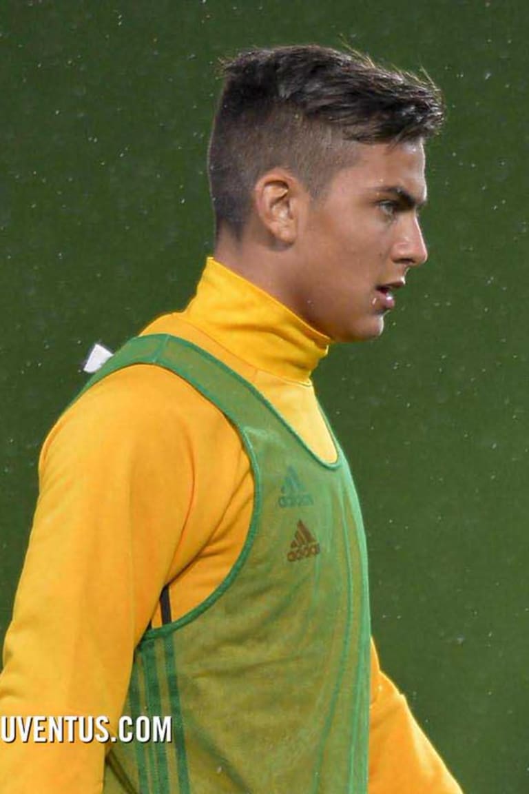 Dybala medical update 
